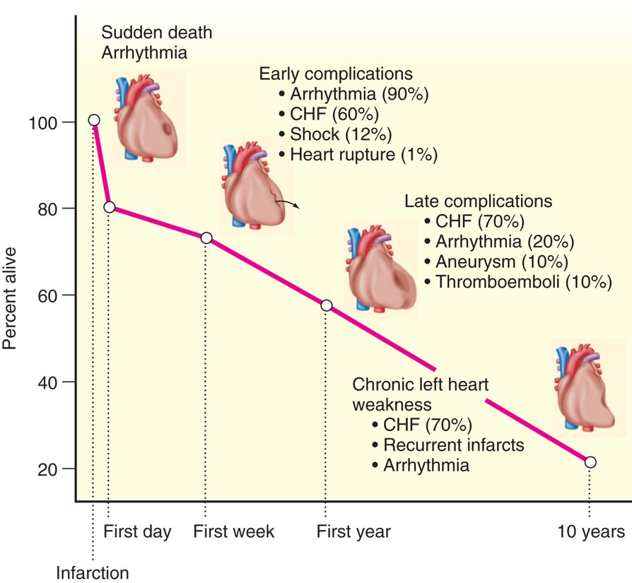 Outcome of myocardial infarction. Forty percent of 1-week survivors have late complications ...