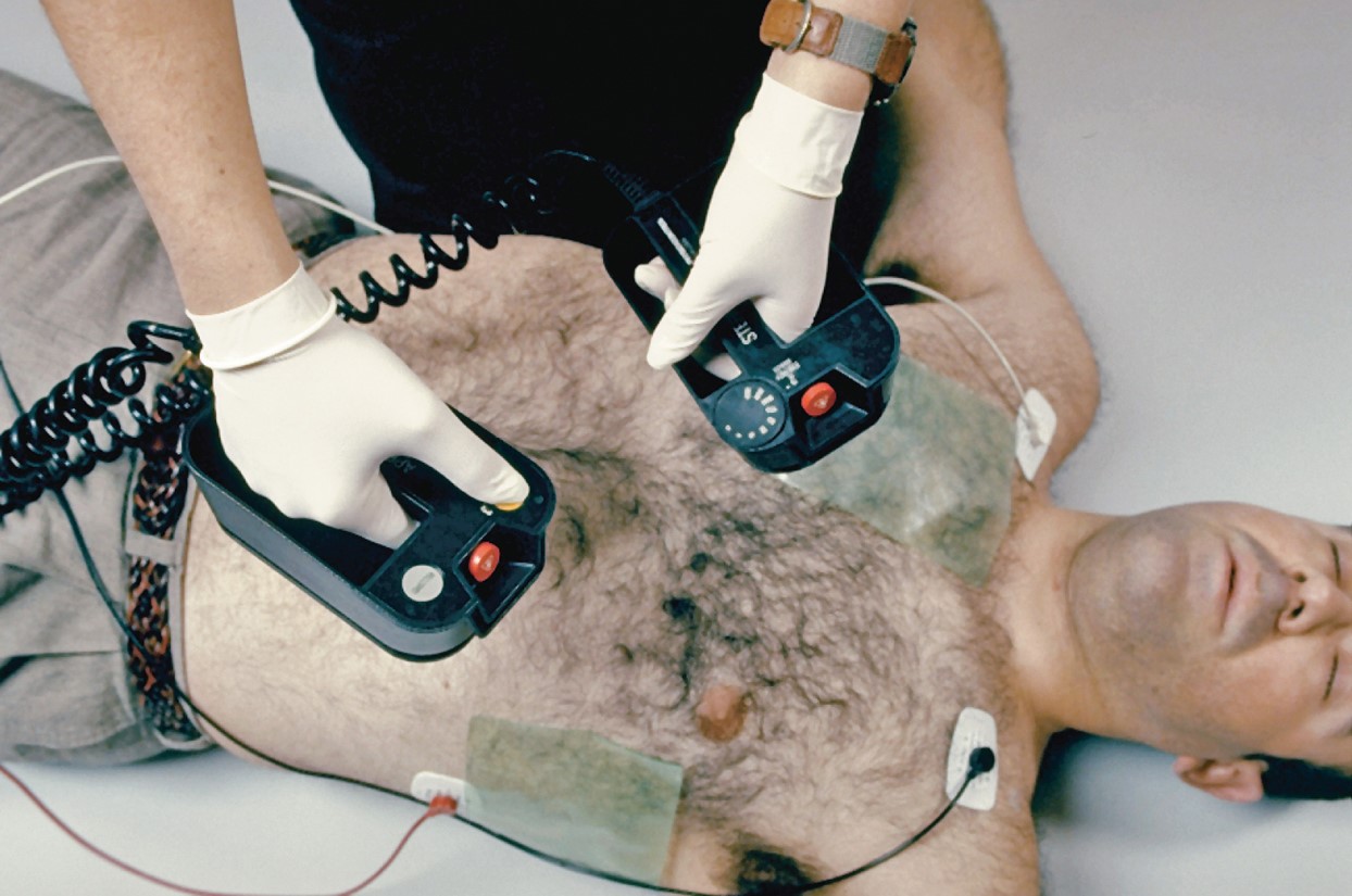 Electrocardioversion paddles.