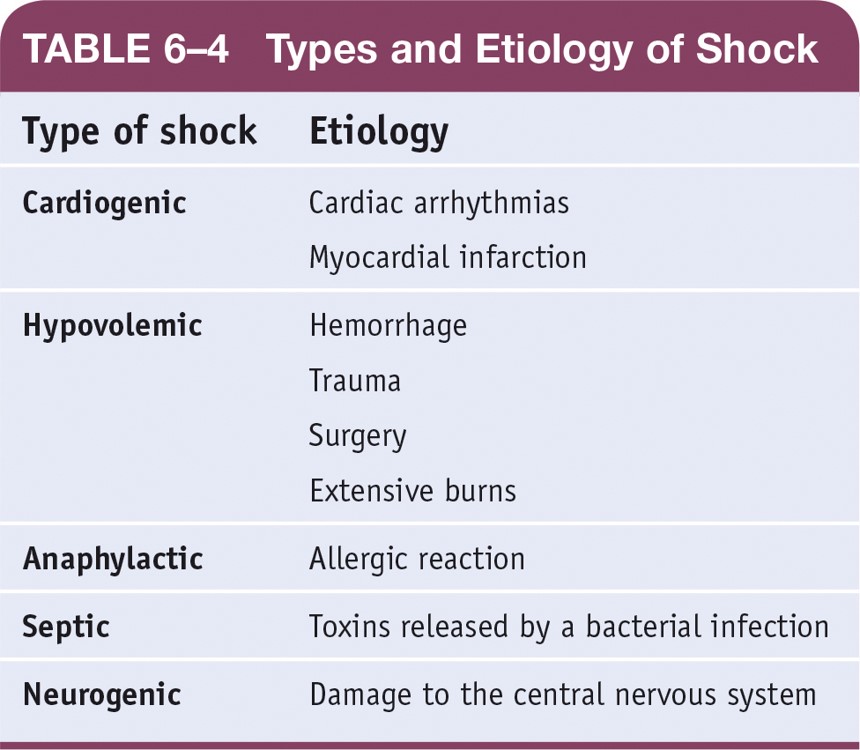 Types of Etiology of Shock 