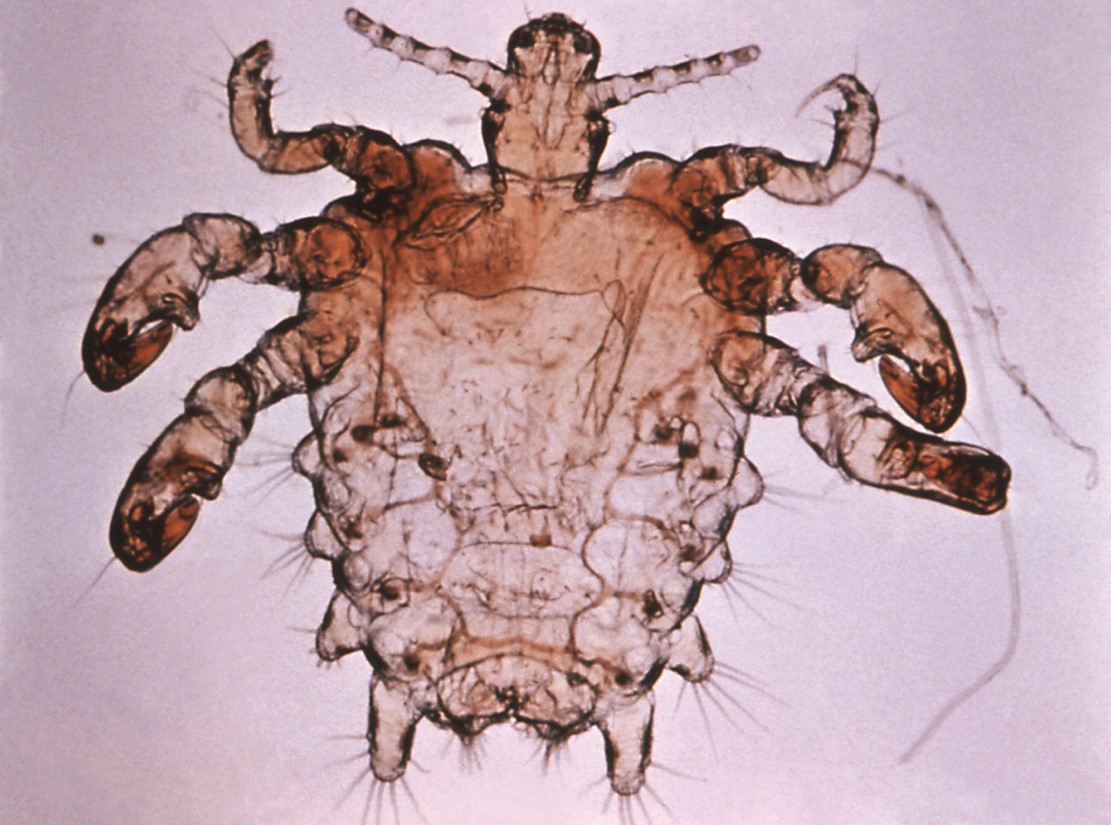 Pubic louse.