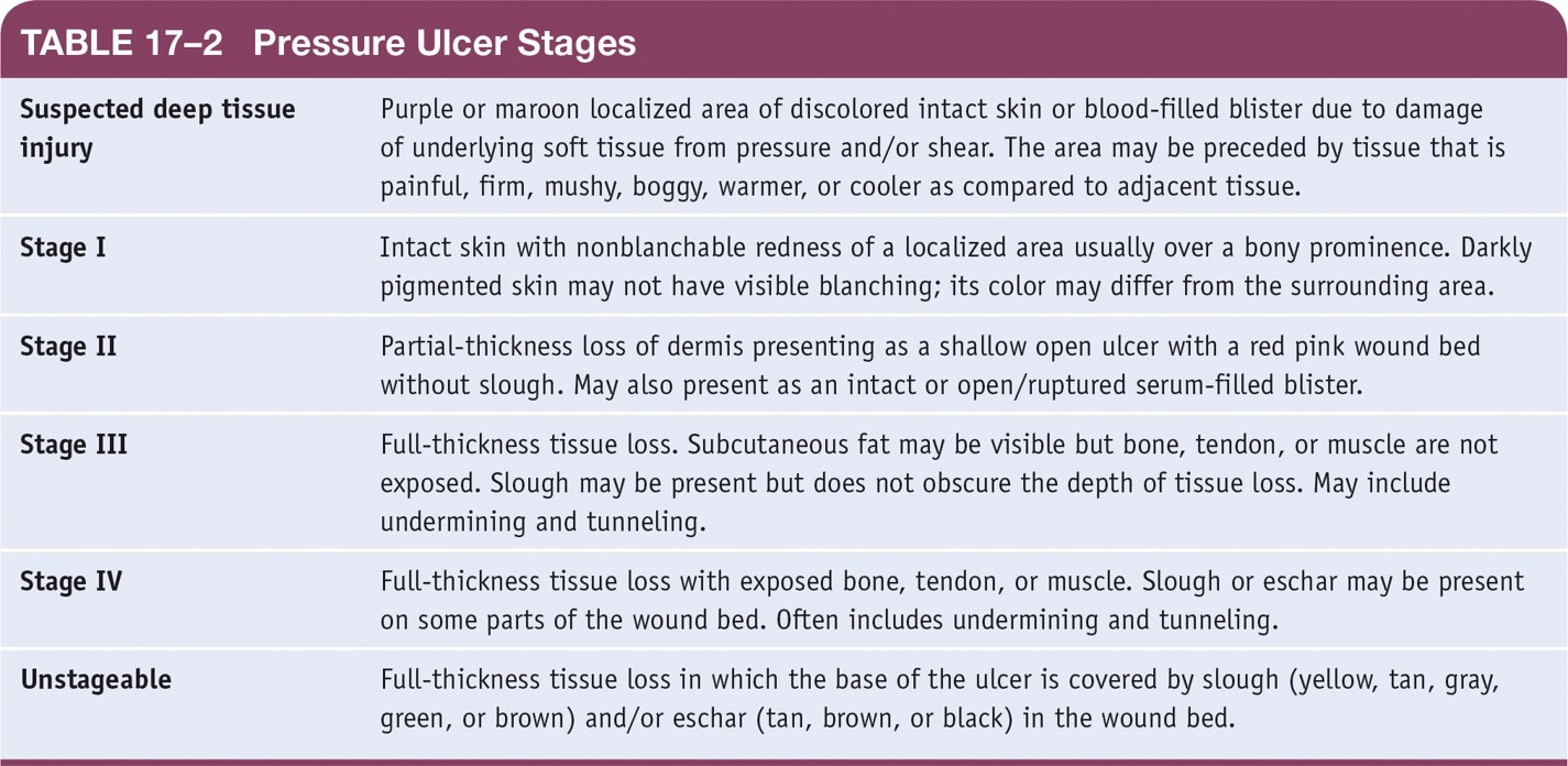 Pressure Ulcer Stages 