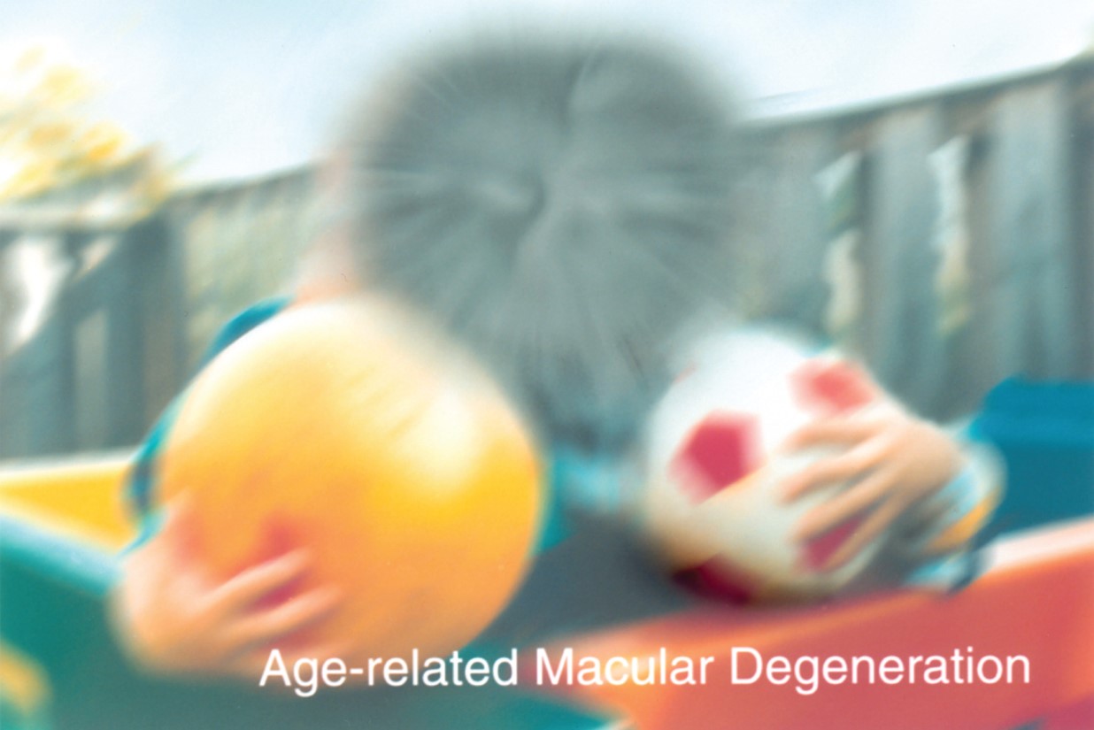 Simulated vision with macular degeneration. 