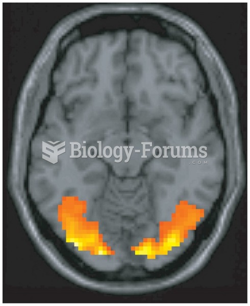 Functional brain imaging is the major method of cognitive neuroscience. This image—taken from the ...