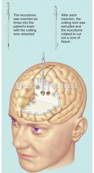 The prefrontal lobotomy procedure developed by Moniz and Lima.
