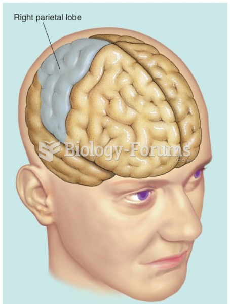 Asomatognosia typically involves damage to the right parietal lobe.