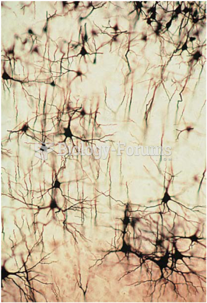 Neural tissue that has been stained by the Golgi method. Because only a few neurons take up the ...