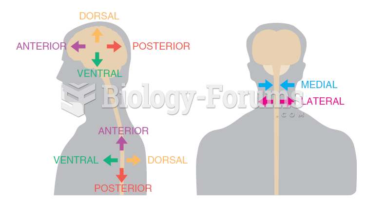 Anatomical directions in a human. Notice that the directions in the cerebral hemispheres are rotated ...