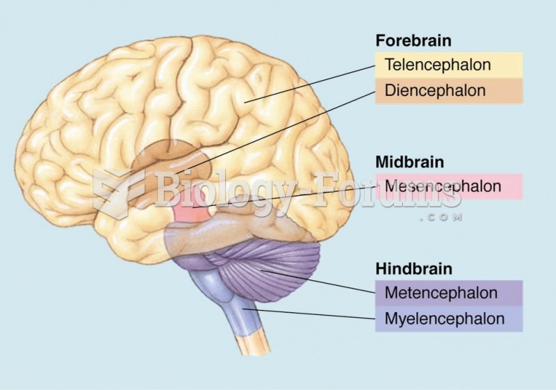 The divisions of the adult human brain.