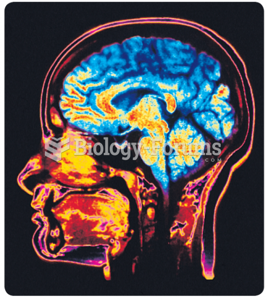 A color-enhanced midsagittal MRI scan.