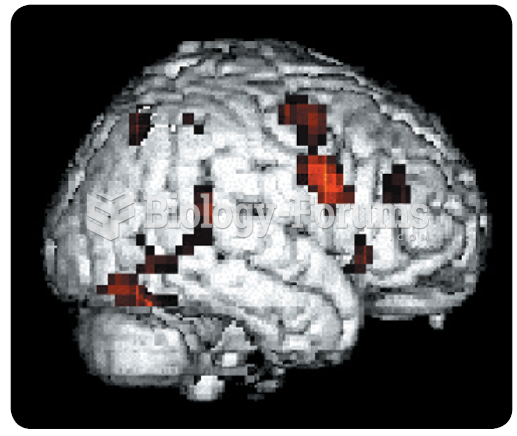 Functional magnetic resonance image (fMRI). This image illustrates the areas of cortex that became ...