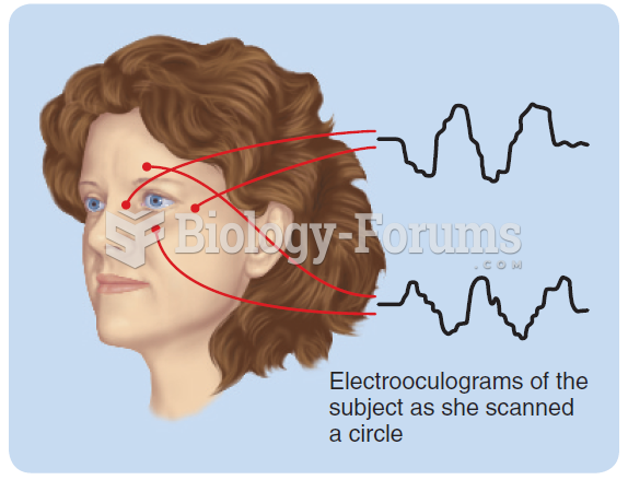 The typical placement of electrodes around the eye for electrooculography. The two electrooculogram ...
