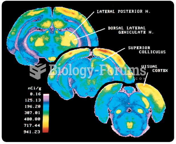 The 2-deoxyglucose technique. The accumulation of radioactivity is shown in three frontal sections ...