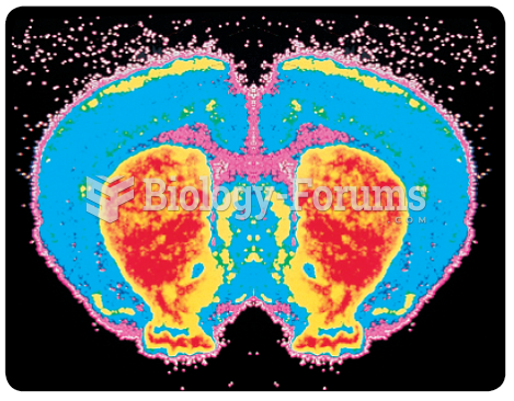 In situ hybridization. This color-coded frontal section through a rat brain reveals high ...