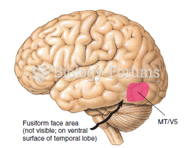 The location of the fusiform face area and the MT area: Damage to the fusiform face area is ...