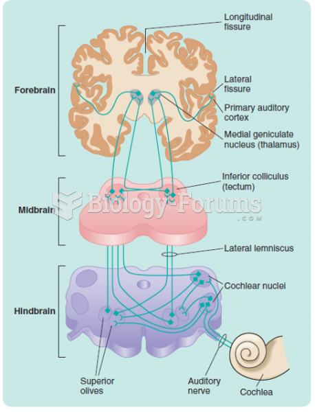 Some of the pathways of the auditory system that lead from one ear to the cortex.
