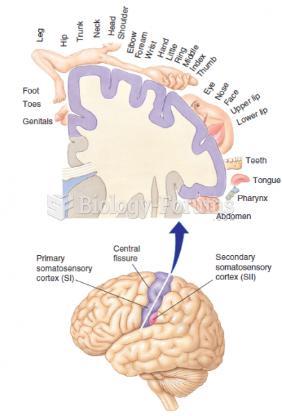 The locations of human primary somatosensory cortex (SI) and one area of secondary somatosensory ...