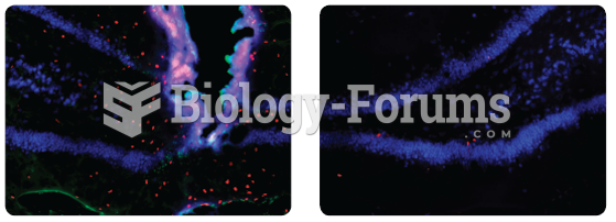 Increased neurogenesis in the dentate gyrus following damage. The left panel shows (1) an ...