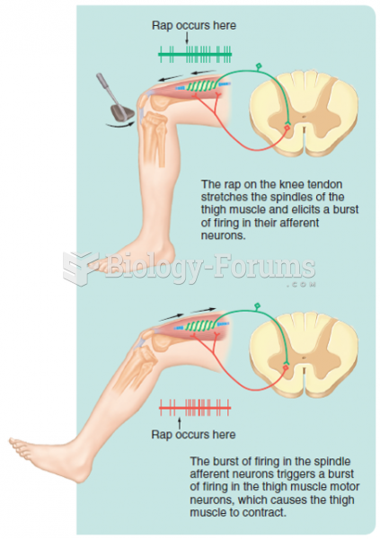 The elicitation of a stretch reflex. All of the muscle spindles in a muscle are activated during a ...