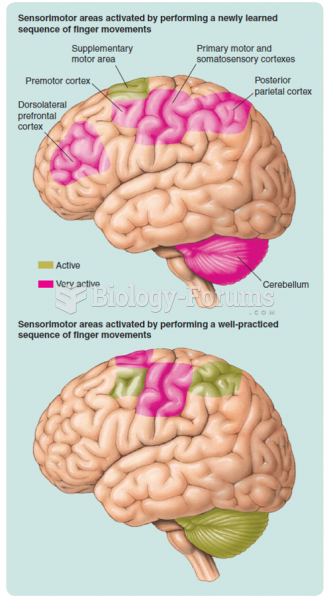 The activity recorded by PET scans during the performance of newly learned and well-practiced ...