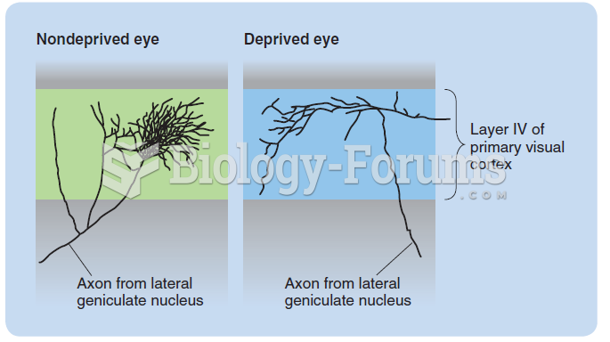 The effect of a few days of early monocular deprivation on the structure of axons projecting from ...