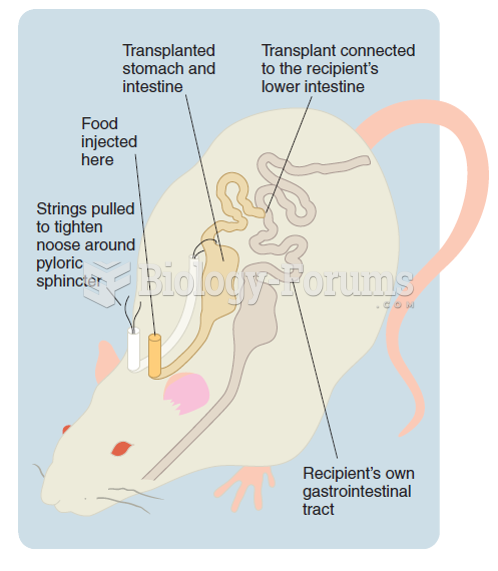 Transplantation of an extra stomach and length of intestine in a rat. Koopmans (1981) implanted an ...