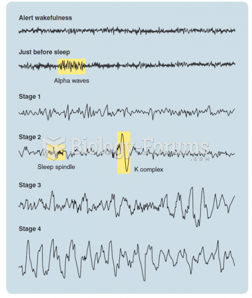 The EEG of alert wakefulness, the EEG that precedes sleep onset, and the four stages of sleep EEG. ...