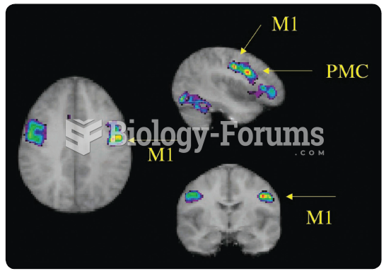 Horizontal, sagittal, and coronal functional MRIs show areas of increased activity in the primary ...