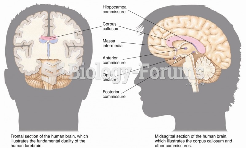 The cerebral hemispheres and cerebral commissures.