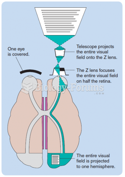 The Z lens, which was developed by Zaidel to study functional asymmetry in split-brain patients. It ...