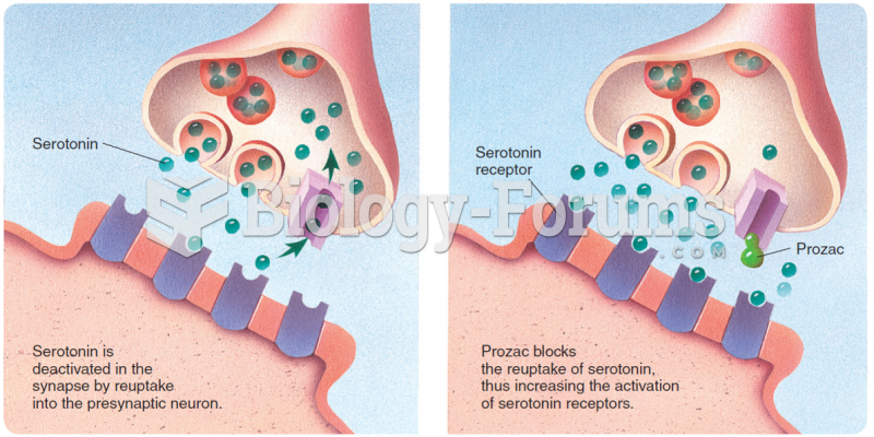 Blocking of serotonin reuptake by fluoxetine (Prozac).