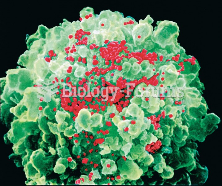 Colored scanning electron micrograph (SEM) of a helper T cell (green) with HIV viruses (red) budding ...