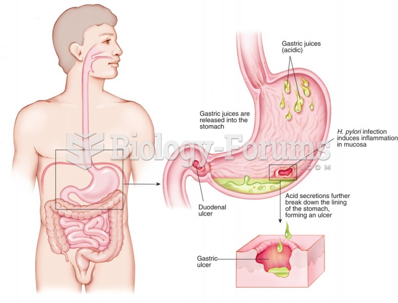 Peptic ulcer disease (PUD).