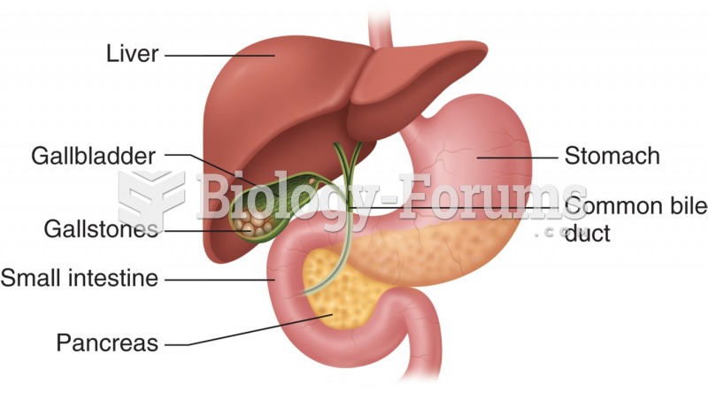 Gallbladder opening showing gallstones.