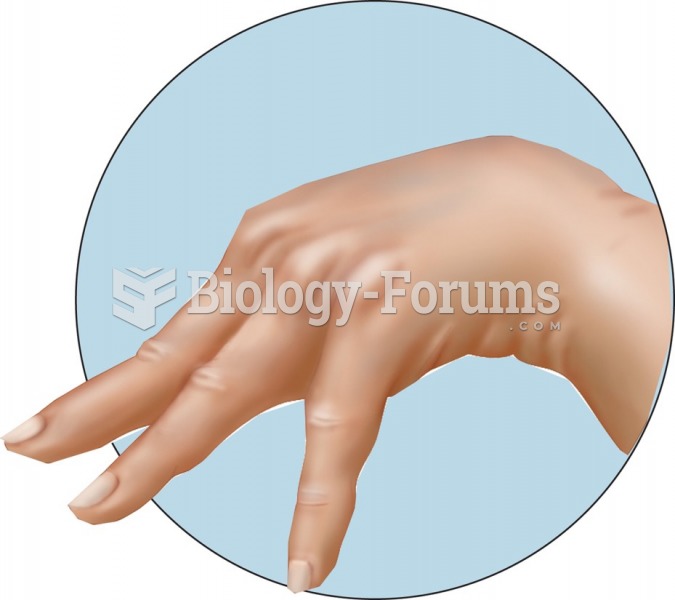 Tetany of the hand in hypoparathyroidism.