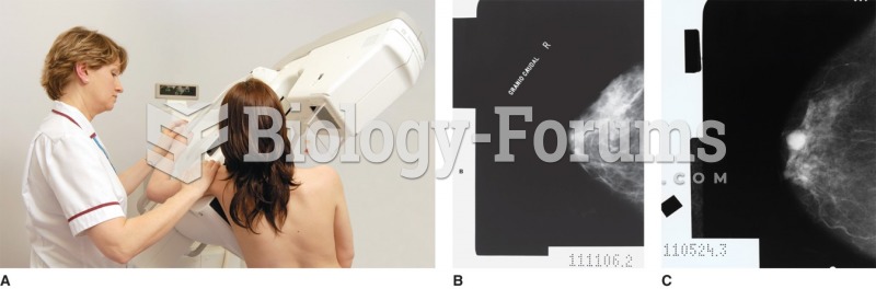 Mammograms. (A) Mammogram procedure. (B) Film of normal breast. (C) Film of breast with tumor. 