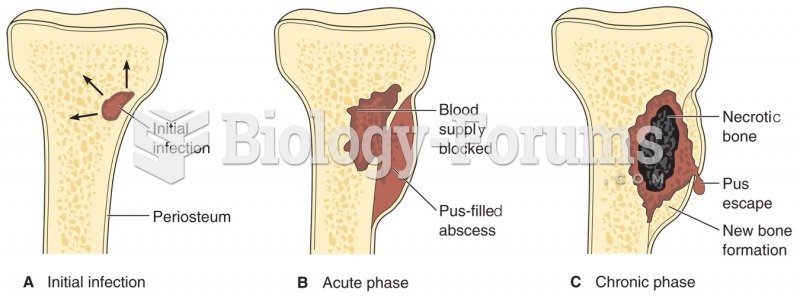 Three phases of bone infection.
