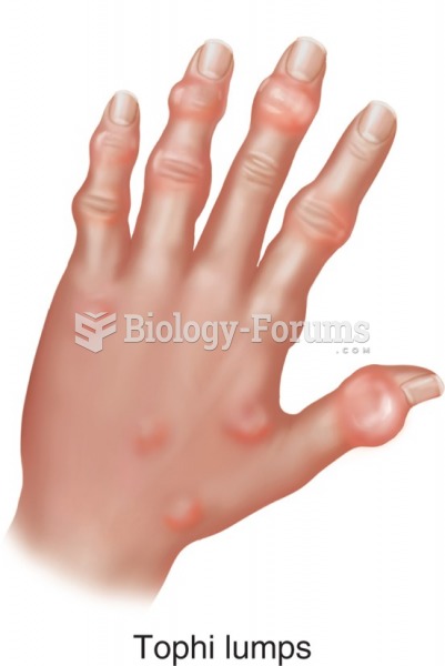Acute arthritis of the finger joints.