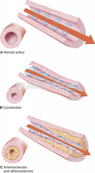 Blood vessels: (A) normal artery; (B) constriction; (C) arteriosclerosis and atherosclerosis.