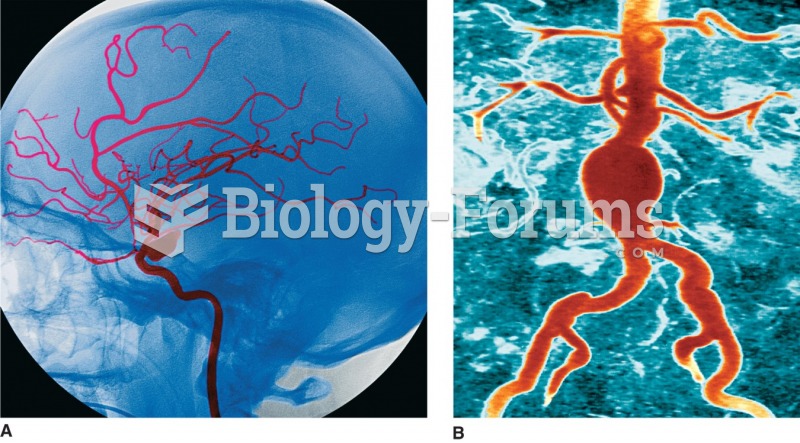 Aneurysms: (A) saccular (Simon Fraser/RNC, Newcastle/Photo Researchers, Inc.); (B) fusiform.