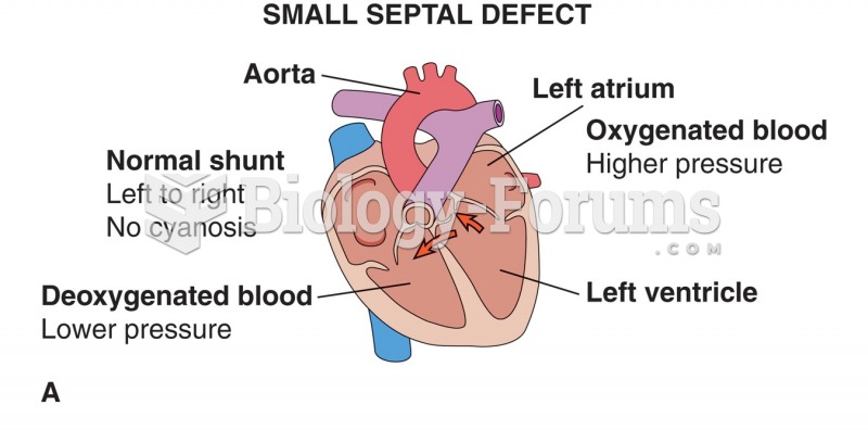 Effects of septal defects: (A) normal shunt; no cyanosis; (B) increased pressure in right ventricle; ...