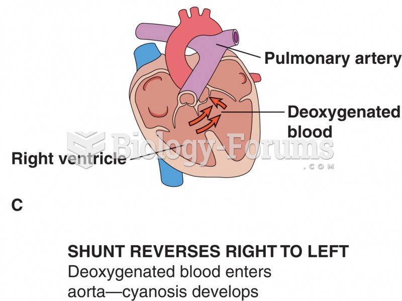 Effects of septal defects: (A) normal shunt; no cyanosis; (B) increased pressure in right ventricle; ...