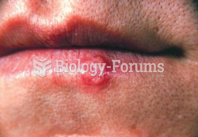 Cold sores or fever blisters. 
