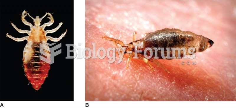 A) Male body louse. (Courtesy of the Centers for Disease Control and Prevention/Frank Collins, Ph.D. ...