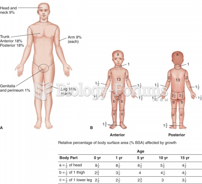 Determining the extent of a burn: (A) rule of nines (adults); (B) Lund-Browder chart (children).