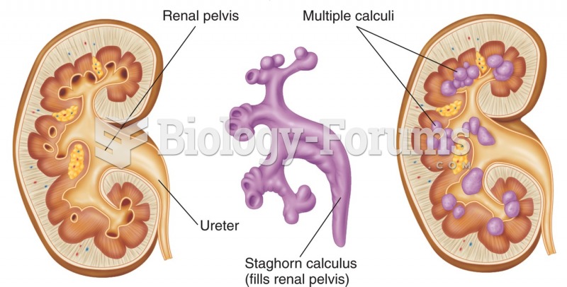 Urinary calculi.