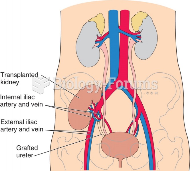 Placement of a transplanted kidney.
