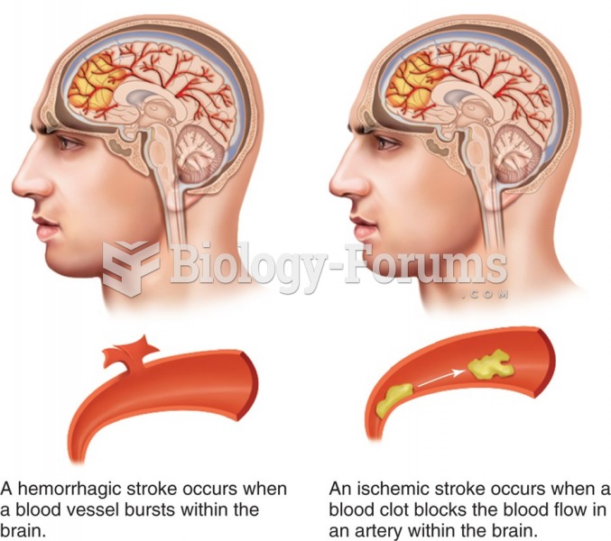 Hemorrhagic and ischemic stroke.