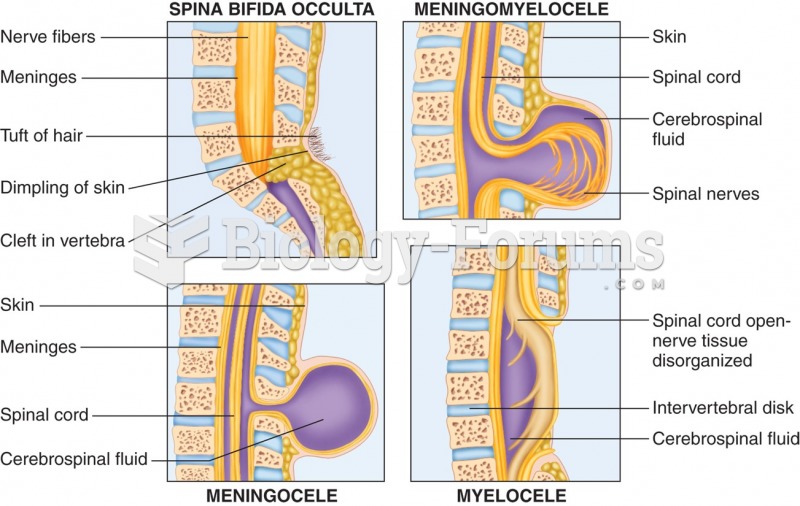 Forms of spina bifida.