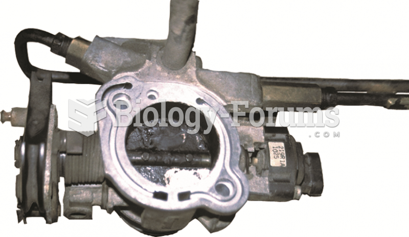 To thoroughly clean a throttle body,  it is sometimes best to remove it from the vehicle.