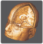 Structural MRI can be used to provide three-dimensional images of the entire brain. (Courtesy of ...